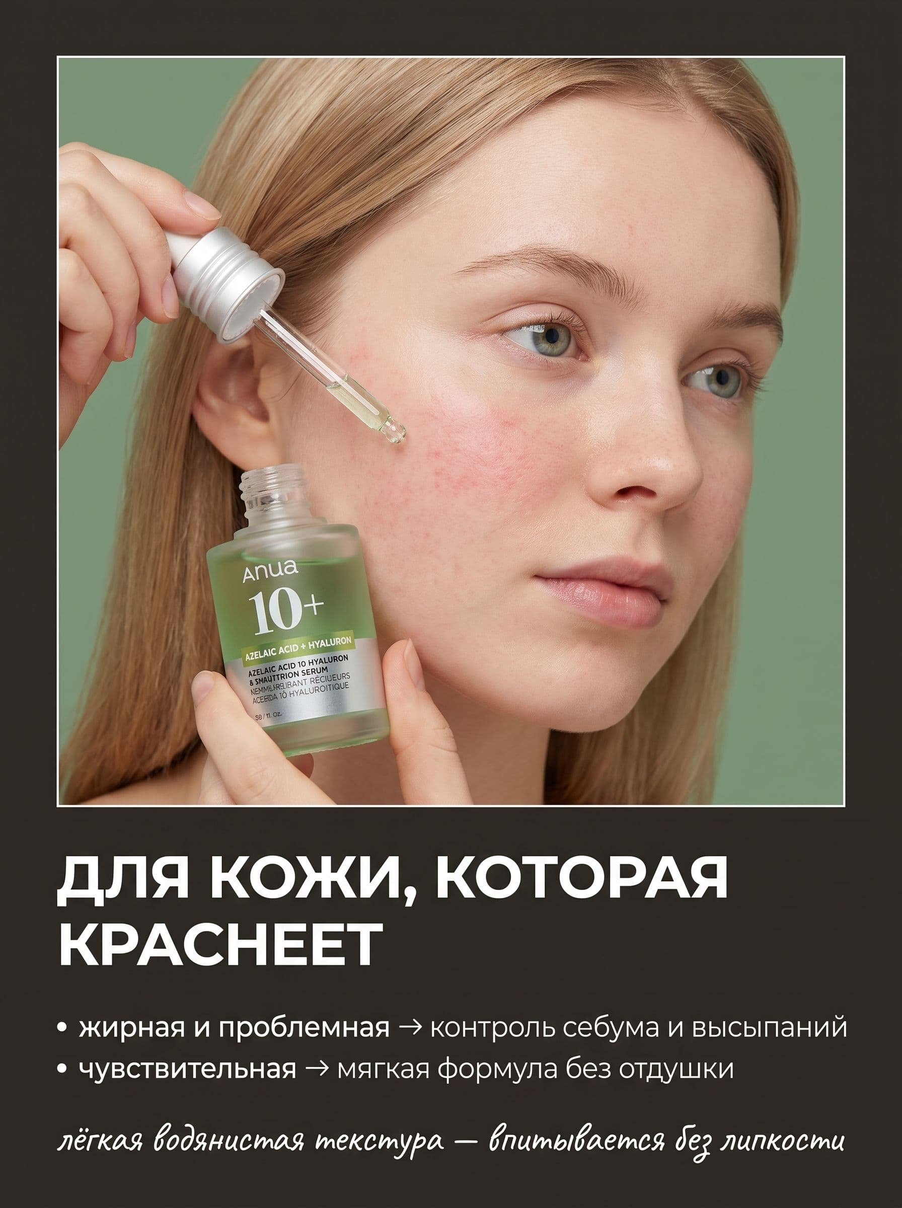 Азелаиновая кислота 10%: как Anua справляется с покраснениями и постакне — фото 4